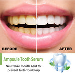 Sérum Blanqueador Dental, Elimina Manchas y Mal Aliento