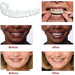 Fundas Dentales Blanqueadoras de Silicona, Superiores e Inferiores