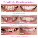Fundas Dentales Blanqueadoras de Silicona, Superiores e Inferiores